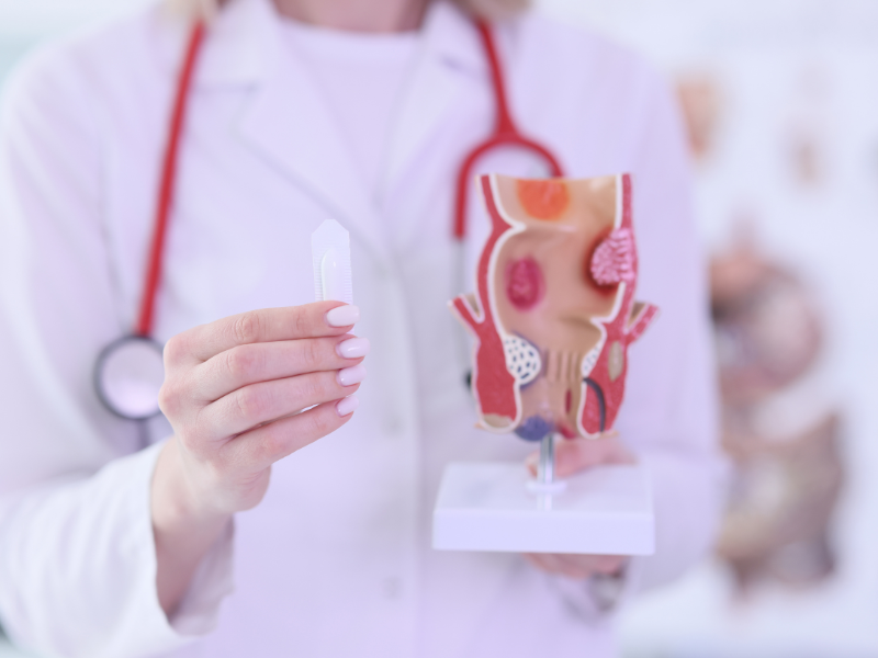 טחורים: מדריך מלא על תסמינים, טיפולים ומניעה