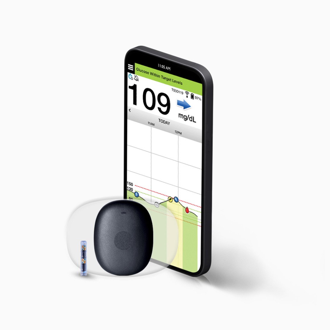 Eversense 365